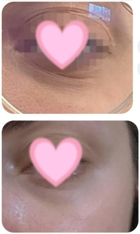 Volufiline Serum